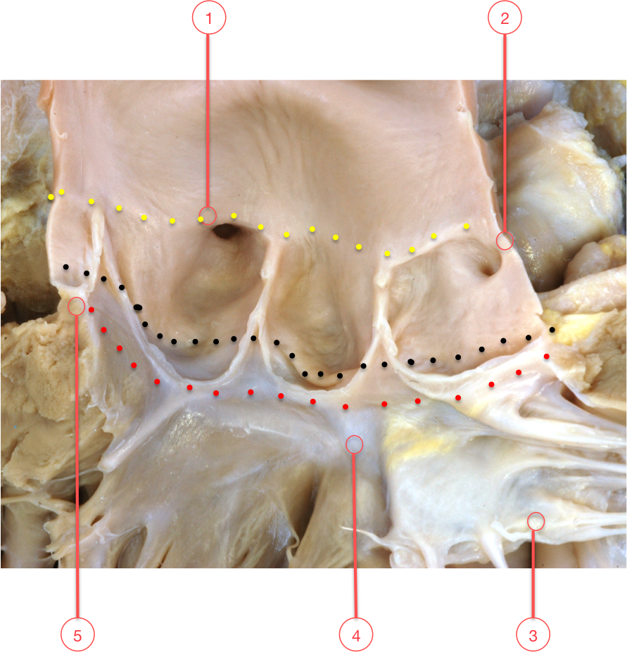 Figure 16. Origins of the coronary arteries