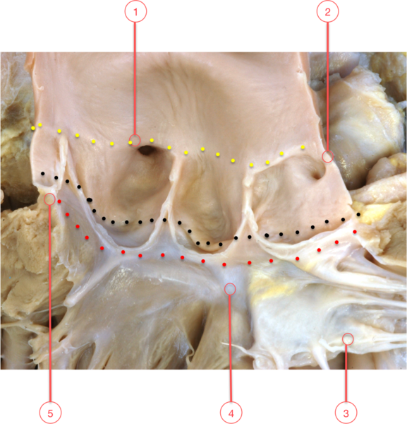 Figure 16. Origins of the coronary arteries