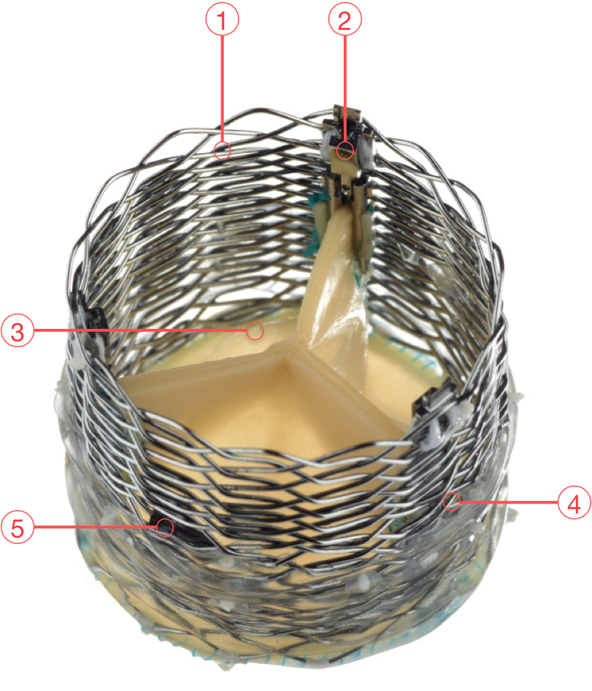 Lotus Valve System: Figure 55 annotation