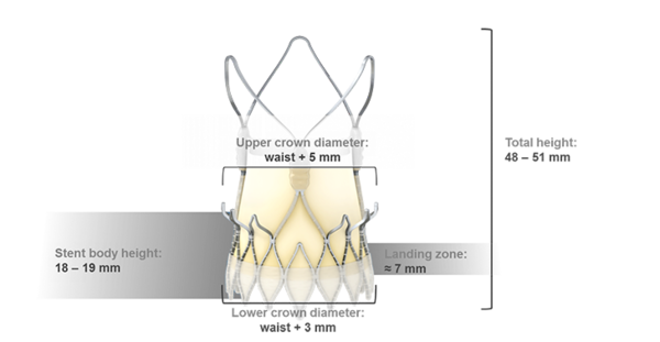 ACURATE neo™ dimension: figure 87 (new)