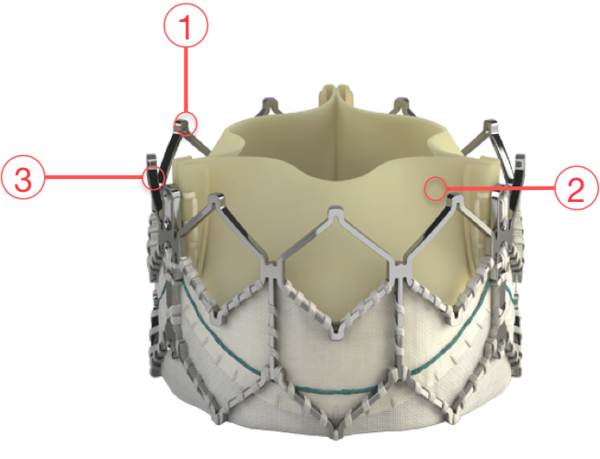 Figure 77. Edwards SAPIEN XT Transcatheter Heart Valve