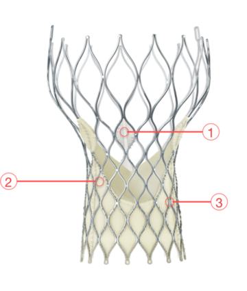 Figure 8. Medtronic CoreValve Transcatheter Aortic Valve