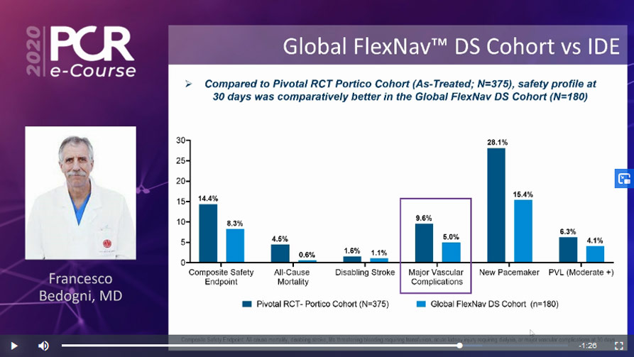 Safety outcomes for the FlexNav DS Global cohort