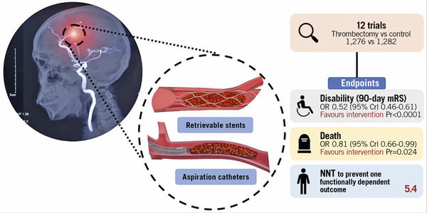 Source: EuroIntervention - Central illustration. Mechanical thrombectomy with retrievable stents and aspiration catheters for acute ischaemic stroke: a meta-analysis of randomised controlled trials.