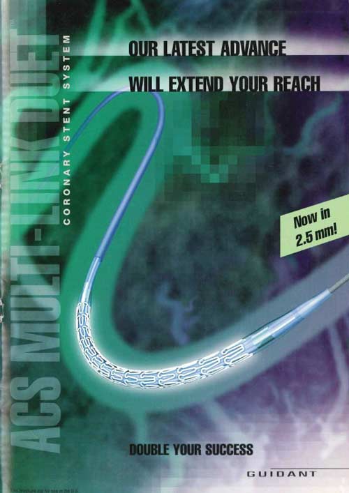 ACS Mukti-link RX Duet coronary stent by Guidant (1998)