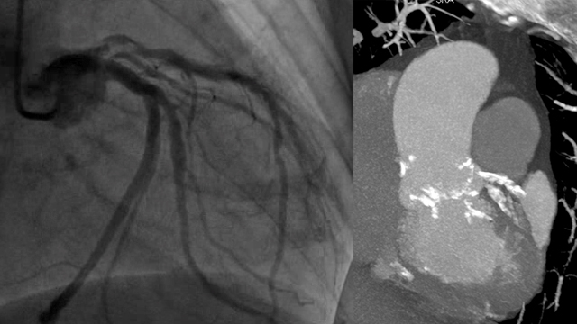 About a complex clinical decision..