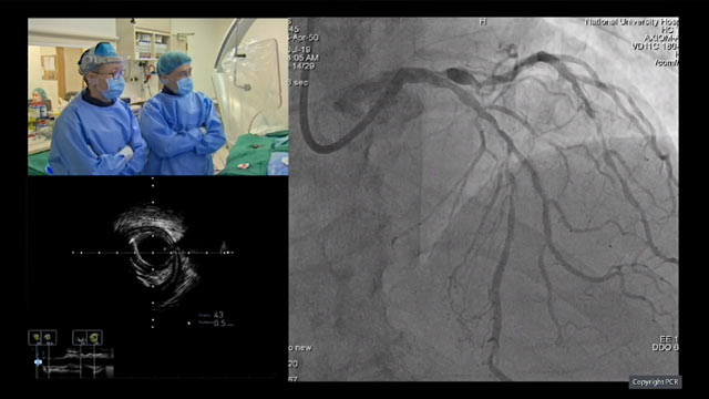 Calcified lesions
