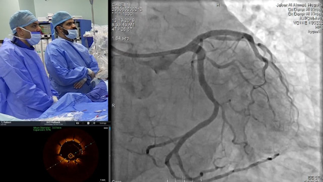 How to optimise PCI in a patient with multivessel disease? LIVE Case