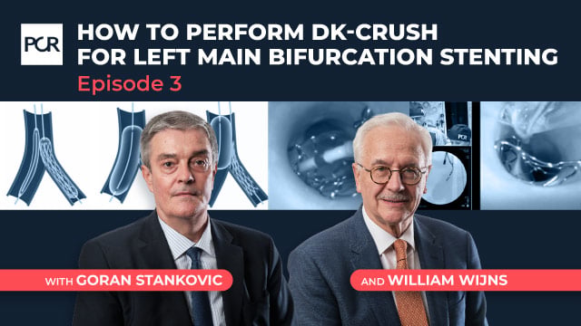 Main vessel stenting in DK-Crush: lessons from stepwise provisional strategy