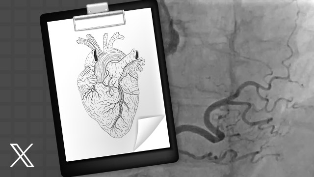 It’s (never) just a quick, diagnostic cath…