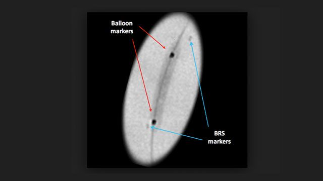 Identify the radiopacity of scaffolds