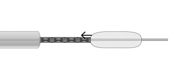 Retrieve scaffold into guiding catheter