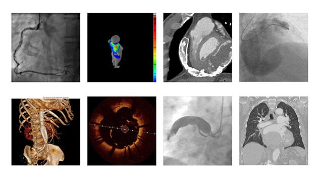 EuroPCR 2016 - An image is worth a 1000 words