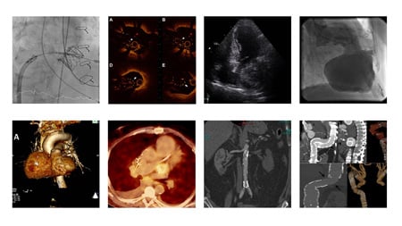 An image is worth a 1,000 words - EuroPCR 2017