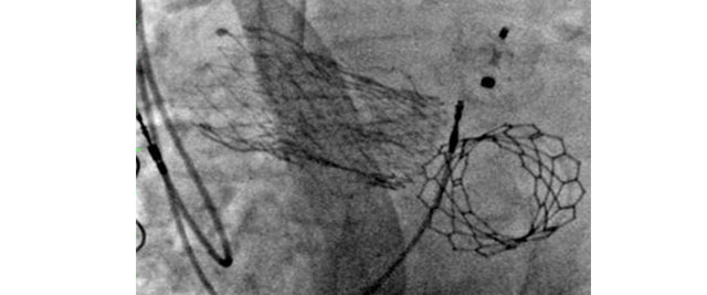  Image in interventional cardiology: In the service of cardiology for 20 years