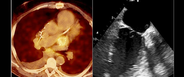Image in cardiology: Your heart knows things your mind can't explain