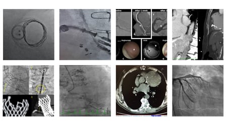 An image is worth a 1,000 words - EuroPCR 2018
