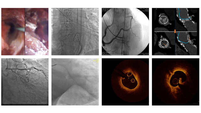 An image is worth a 1,000 words - EuroPCR 2019