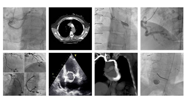 An image is worth a 1,000 words - EuroPCR 2021