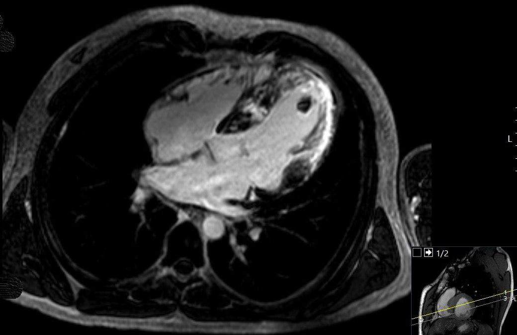 When a common disease has an atypical presentation