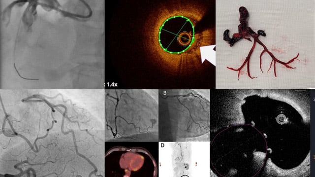 An image is worth 1,000 words - #EuroPCR 2024