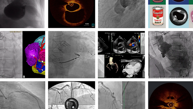 An image is worth 1,000 words - #EuroPCR  2025