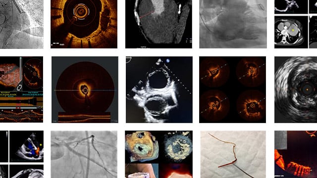 An image is worth 1,000 words - #EuroPCR  2026