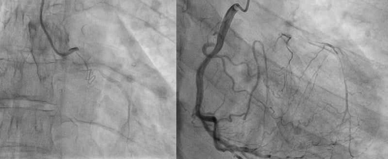 A hidden lifeline in a young heart