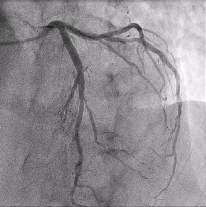 Where is the lesion ? 