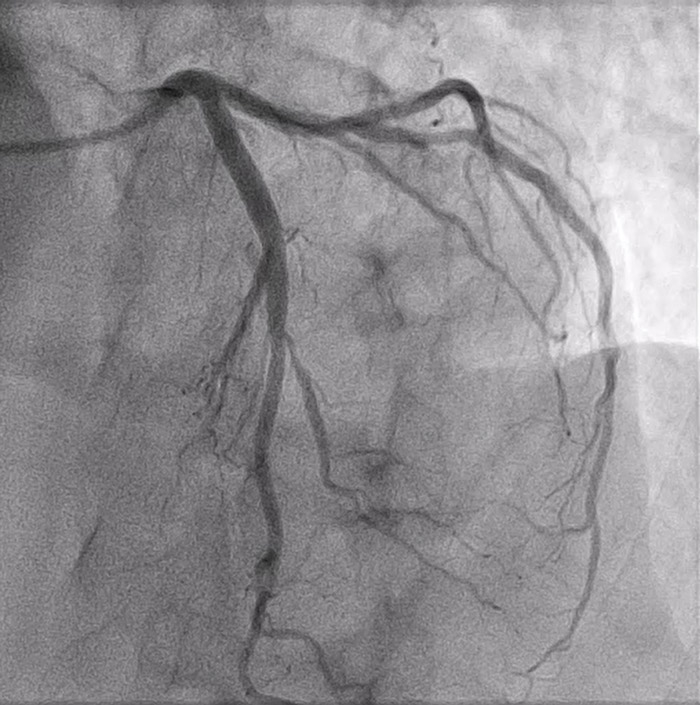Where is the lesion ? 