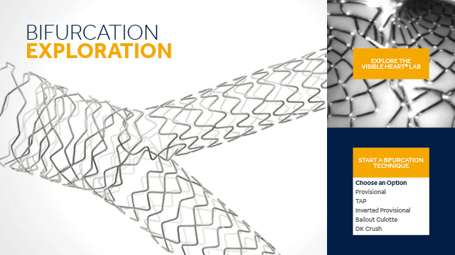Bifurcation Exploration website: Bifurcation visualisations from a whole new perspective