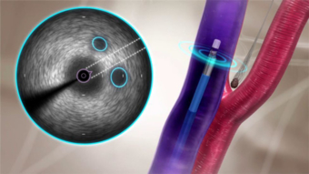 Sharad Shetty Sharad tandon is a cardiologist in gurgaon sector 44. sharad shetty