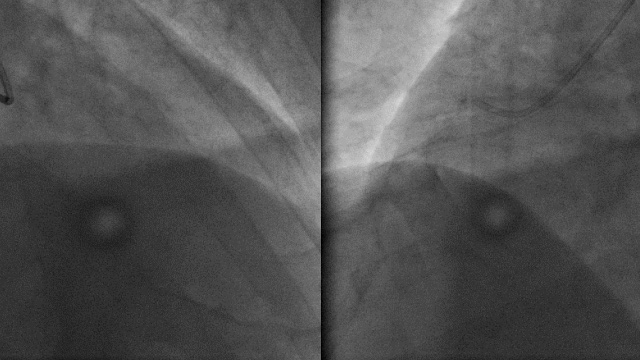 Challenging cases