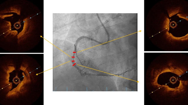 Challenging cases