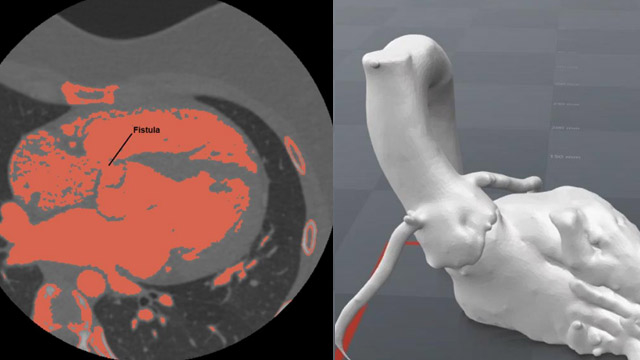 Closing holes: a florilege of complex cases