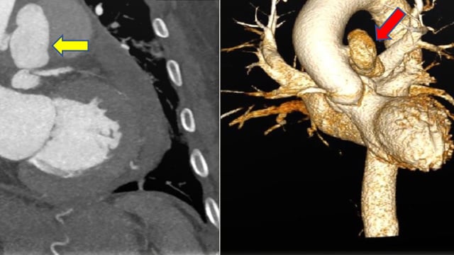 Complex and challenging cases I