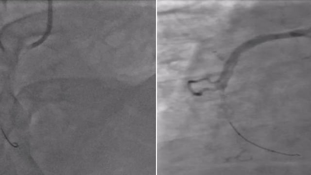 Complex and challenging cases II