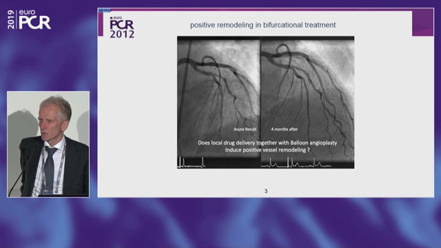 Go implant-free in de novo lesions: DCB-only strategy