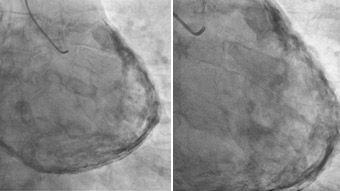Have you ever seen that before? Rare cases and complications