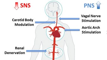 Interventional neuromodulation – Indications beyond hypertension