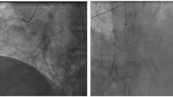 Never give up! A florilege of super complex cases