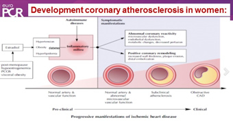 Obstructive and non-obstructive coronary disease in women