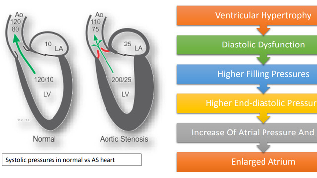 Solving the mysteries of cardiac physiology - Back to basics