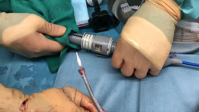 TAVI complications: CoreValve