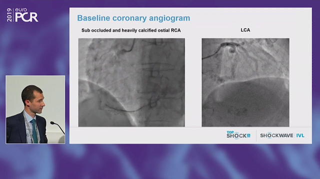 TopShock 2019: honouring the best intravascular lithotripsy cases from the past year