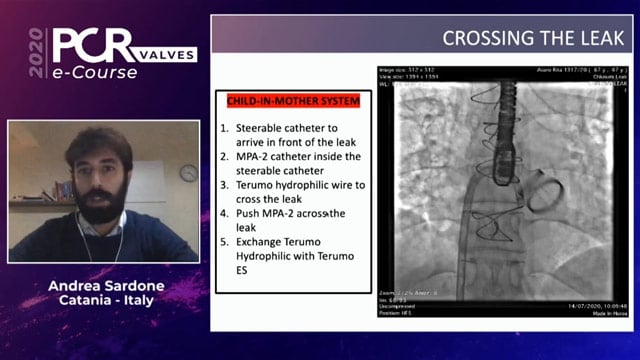 Best mitral and tricuspid cases