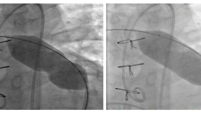 Challenging cases