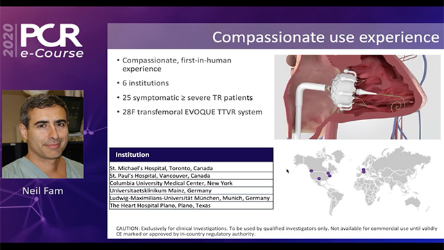 Hot lines on tricuspid interventions