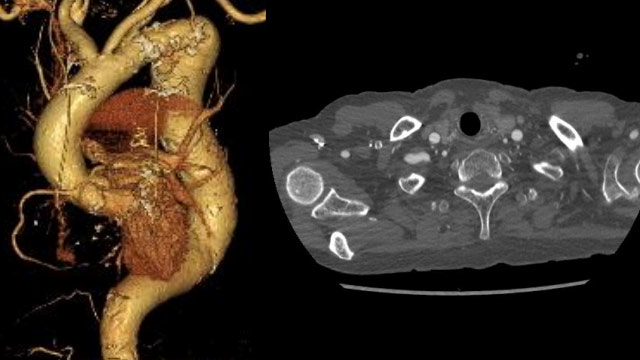 My best and worst cases of vascular access