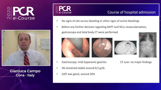 Non-culprit stenosis revasc. in STEMI patients with MVD: which, when and how?